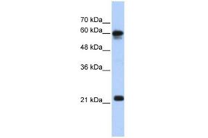 SEMA4F antibody used at 1 ug/ml to detect target protein. (SEMA4F 抗体  (N-Term))