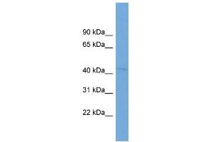 WB Suggested Anti-RABEPK Antibody Titration: 0. (RABEPK 抗体  (N-Term))