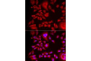 Immunofluorescence analysis of HeLa cell using BLMH antibody. (BLMH 抗体)