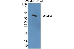 Detection of Recombinant CNTN4, Human using Polyclonal Antibody to Contactin 4 (CNTN4) (Contactin 4 抗体  (AA 731-980))
