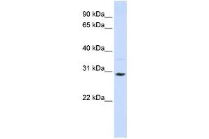 Western Blotting (WB) image for anti-Solute Carrier Family 25 (Carnitine/acylcarnitine Translocase), Member 20 (SLC25A20) antibody (ABIN2458773) (SLC25A20 抗体)