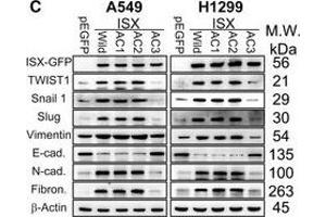 Western Blotting (WB) image for anti-Vimentin (VIM) antibody (ABIN2854814)