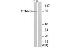 Western blot analysis of extracts from HT-29 cells, treated with Forskolin, using Catenin-beta (Ab-37) Antibody. (beta Catenin 抗体  (AA 3-52))