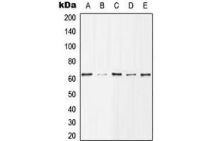 Western blot analysis of Histone Deacetylase 1 (pS421) expression in MCF7 EGF-treated (A), Jurkat (B), NIH3T3 (C), mouse spleen (D), H9C2 EGF-treated (E) whole cell lysates. (HDAC1 抗体  (C-Term, pSer421))