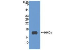 Detection of Recombinant POSTN, Human using Monoclonal Antibody to Periostin (POSTN) (Periostin 抗体  (AA 97-230))