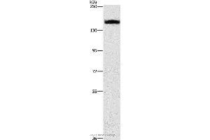 Western blot analysis of A431 cell, using ITGA2 Polyclonal Antibody at dilution of 1:300 (ITGA2 抗体)