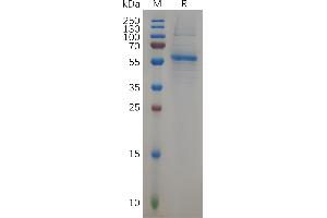Human KRAS Protein, hFc Tag on SDS-PAGE under reducing condition. (K-RAS Protein (AA 2-185) (Fc Tag))