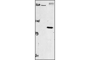 Western blot of chicken brain tissue incubated with CLC4 Antibody . (CLCN4 抗体  (C-Term))