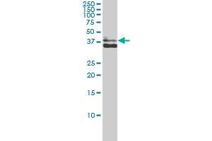 Western Blotting (WB) image for anti-Aldo-keto Reductase Family 1 Member C4 (AKR1C4) (AA 1-323) antibody (ABIN560358)