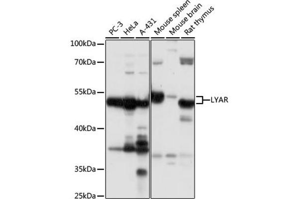 LYAR 抗体  (AA 10-160)