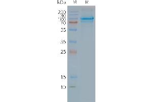 Human CL-Nanodisc, Flag Tag on SDS-PAGE (CLPTM1 蛋白)