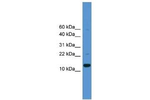 WB Suggested Anti-CASP1  Antibody Titration: 0. (Caspase 1 抗体  (Middle Region))