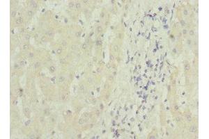 Immunohistochemistry of paraffin-embedded human liver tissue using ABIN7159842 at dilution of 1:100 (MTCH1 抗体  (AA 100-250))