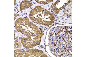 Immunohistochemistry of paraffin-embedded human kidney using TGS1 antibody (ABIN5975205) at dilution of 1/100 (40x lens). (TGS1 抗体)