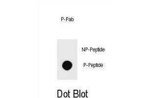 Dot blot analysis of Phospho-PTEN- Antibody Phospho-specific Pab (ABIN6241047 and ABIN6578933) on nitrocellulose membrane. (PTEN 抗体  (pSer229))