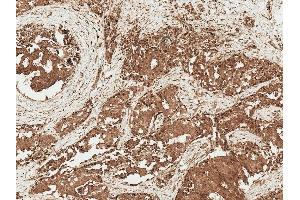 Immunohistochemistry analysis using Rabbit Anti-AKT1 Polyclonal Antibody (ABIN5667429). (AKT1 抗体  (AA 100-200) (HRP))