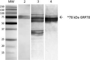 Western Blot analysis of Human, Mouse, Rat NIH3T3, Rat Brain, and HEK-293 cell lysates showing detection of ~78 kDa GRP78 protein using Mouse Anti-GRP78 Monoclonal Antibody, Clone 3C5-1A4 . (GRP78 抗体  (APC))