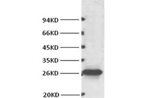 Western Blot analysis of Hela cells using BCL2 Monoclonal Antibody at dilution of 1:1000. (Bcl-2 抗体)
