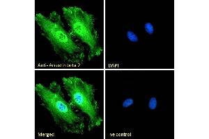 Immunofluorescence (IF) image for anti-Arrestin, beta 2 (ARRB2) (Internal Region) antibody (ABIN185395)