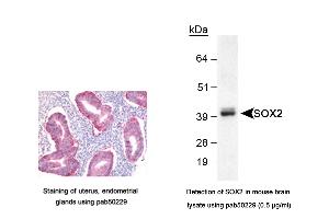 Image no. 3 for anti-SRY (Sex Determining Region Y)-Box 2 (SOX2) (AA 1-100), (N-Term) antibody (ABIN363538) (SOX2 抗体  (N-Term))