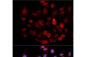 Immunofluorescence analysis of MCF-7 cells using Phospho-ABL1(Y412) Polyclonal Antibody (ABL1 抗体  (pTyr412))