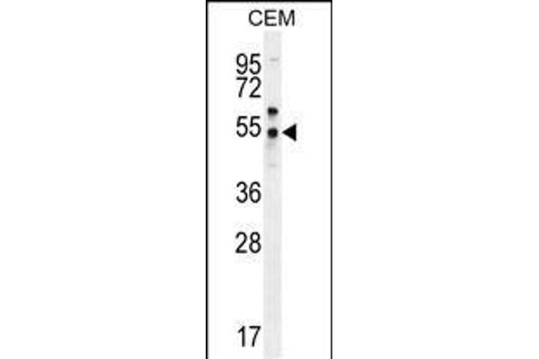 FOLH1B 抗体  (C-Term)