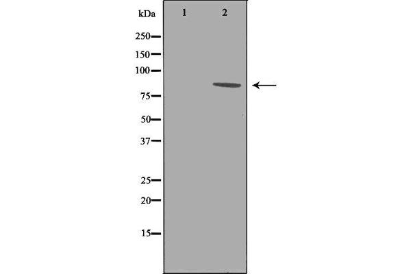 EEF2K 抗体  (Internal Region)