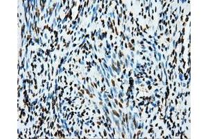 Immunohistochemistry (IHC) image for anti-Amyloid beta (A4) Precursor Protein (APP) antibody (ABIN1496877) (APP 抗体)