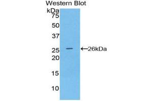 Western blot analysis of recombinant Human CD72. (CD72 抗体  (AA 169-359))