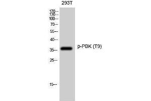 Western Blotting (WB) image for anti-PDZ Binding Kinase (PBK) (pThr9) antibody (ABIN3173023) (PBK 抗体  (pThr9))