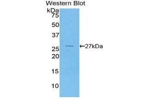 Western Blotting (WB) image for anti-Pyruvate Dehydrogenase Kinase 1 (PDK1) (AA 233-430) antibody (ABIN1860171) (PDK1 抗体  (AA 233-430))