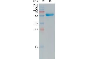 Coxsackie Adenovirus Receptor Protein (AA 20-237) (Fc Tag)
