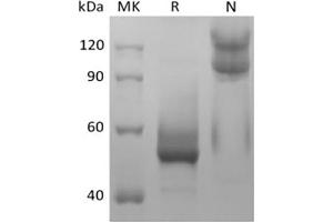 Western Blotting (WB) image for Tumor Necrosis Factor (Ligand) Superfamily, Member 13b (TNFSF13B) protein (ABIN7320913) (BAFF 蛋白)