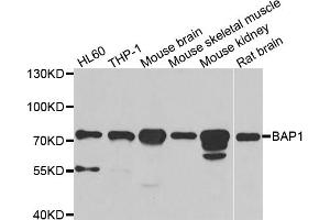 Western blot analysis of extracts of various cell lines, using BAP1 antibody (ABIN5973917) at 1/1000 dilution. (BAP1 抗体)