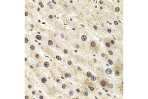 Immunohistochemistry of paraffin-embedded human liver injury using HNRNPD Antibody (ABIN5970929) at dilution of 1/100 (40x lens). (HNRNPD/AUF1 抗体)