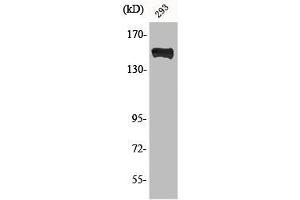 Western Blot analysis of 293 cells using Phospho-PLC γ1 (Y783) Polyclonal Antibody (Phospholipase C gamma 1 抗体  (pTyr753))