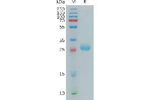 Human A2 Protein, His Tag on SDS-PAGE under reducing condition. (BTN3A2 Protein (AA 30-248) (His tag))