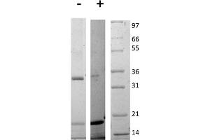 SDS-PAGE of Rat Interleukin-17E (IL-25) Recombinant Protein SDS-PAGE of Rat Interleukin-17E (IL-25) Recombinant Protein. (IL-25 蛋白)