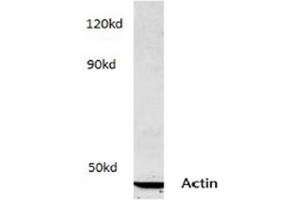 Image no. 2 for anti-Actin (pan) antibody (ABIN265298) (Actin 抗体  (pan))