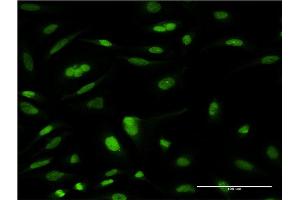 Immunofluorescence of monoclonal antibody to TCEA3 on HeLa cell. (TCEA3 抗体  (AA 1-348))