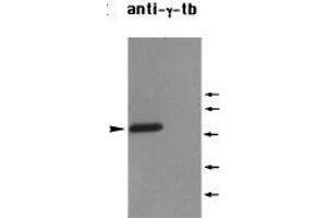 Western Blotting (WB) image for anti-Tubulin, gamma 1 (TUBG1) (C-Term) antibody (ABIN2451983) (TUBG1 抗体  (C-Term))
