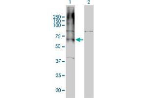 Western Blotting (WB) image for anti-gamma-aminobutyric Acid (GABA) B Receptor, 1 (GABBR1) (AA 52-151) antibody (ABIN560976)