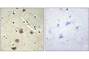 Immunohistochemistry analysis of paraffin-embedded human brain tissue, using AK5 Antibody. (Adenylate Kinase 5 抗体  (AA 391-440))