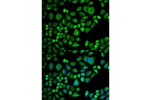 Immunofluorescence analysis of A549 cells using APOD antibody (ABIN5973043). (Apolipoprotein D 抗体)