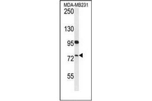 Western blot analysis of HFM1 Antibody (C-term) in MDA-MB231 cell line lysates (35ug/lane). (HFM1 抗体  (C-Term))