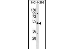 Western blot analysis in NCI-H292 cell line lysates (35ug/lane). (Annexin a10 抗体  (C-Term))