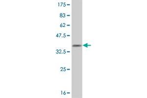 Western Blot detection against Immunogen (34. (OLIG1 抗体  (AA 80-159))