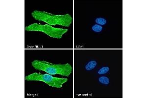 Immunofluorescence (IF) image for anti-Nitric Oxide Synthase 1, Neuronal (NOS1) (C-Term) antibody (ABIN184662)