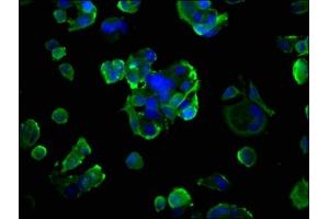 Immunofluorescence staining of MCF-7 cells with ABIN7143554 at 1:200, counter-stained with DAPI. (RAGE 抗体  (AA 23-342))
