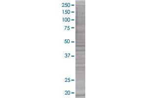 FTL transfected lysate (FTL 293T Cell Transient Overexpression Lysate(Denatured))